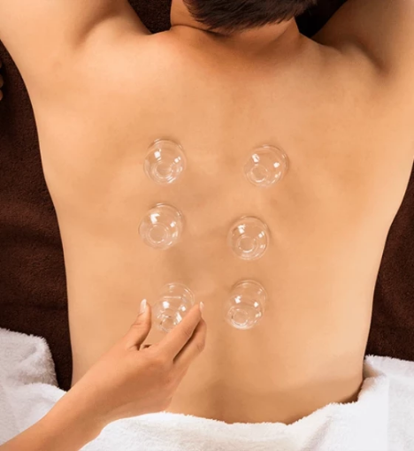 صورة الحجامة الجافة - توازن واسترخاء