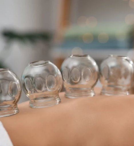 صورة جلسة حجامة بـ 12 كاسة – استشفاء شامل وراحة تامة