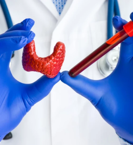 صورة باقة تحاليل الغدة الدرقية الشاملة - تقييم كامل لصحة الغدة الدرقية ووظائفها