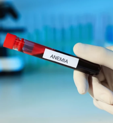 صورة باقة تحاليل الدم الشاملة – تقييم متكامل لصحة الدم