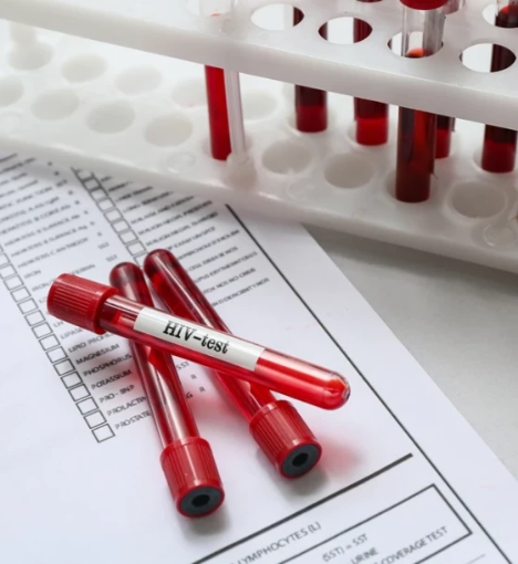 صورة باقة تحاليل الأمراض المعدية - للكشف المبكر عن الأمراض المنقولة جنسيًا