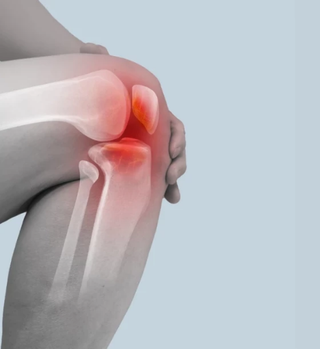 صورة باقة تحاليل التهاب المفاصل - للكشف عن الالتهابات وتحليل وظائف الجهاز المناعي