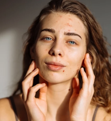 صورة باقة متابعة الروكتان - لمراقبة وظائف الكبد وصحة الدهون أثناء العلاج