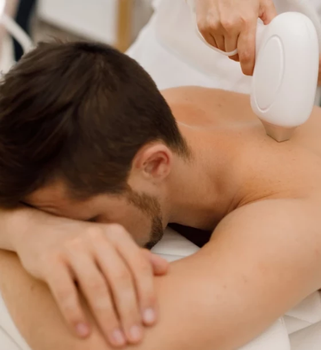 صورة جلسة ليزر إزالة الشعر للجسم الكامل (بما في ذلك الظهر والبطن) - للرجال