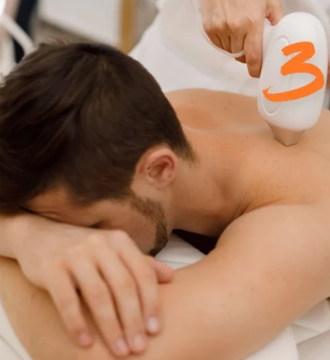 صورة ثلاث جلسات ليزر إزالة الشعر للجسم الكامل - للرجال