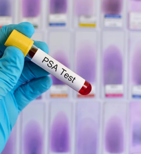 صورة باقة تحاليل العناية بالبروستات - فحص صحة البروستات