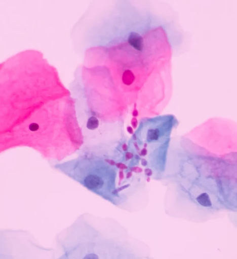 صورة مجموعة تحاليل شاملة العناية بالصحة الجنسية - فحص طبي شامل لقييم الصحة الجنسية