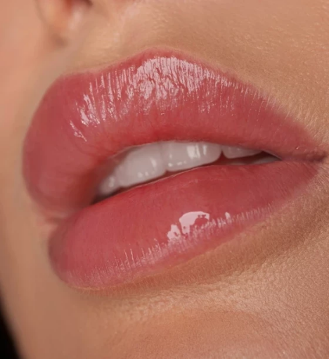 صورة توريد الشفايف بالليزر- شفايف وردية طبيعية ومشرقة