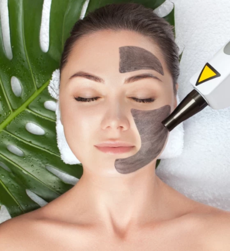 صورة جلسة الليزر الكربوني للنضارة - منطقة واحدة