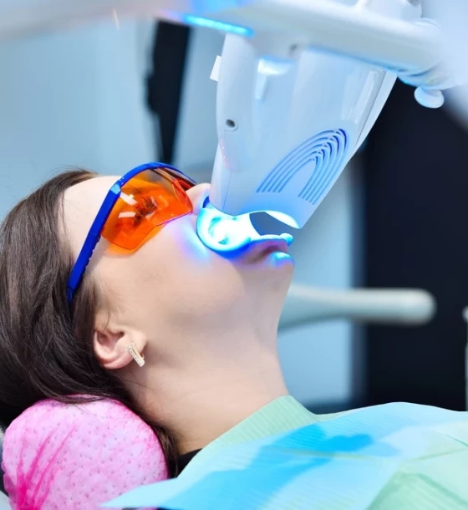 صورة تبييض الأسنان بالليزر