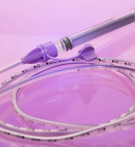 صورة خدمة إزالة أنبوب التغذية الأنفي المعدي