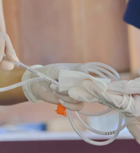 صورة خدمة تركيب الأنبوبة الغذائية الأنفية في المنزل