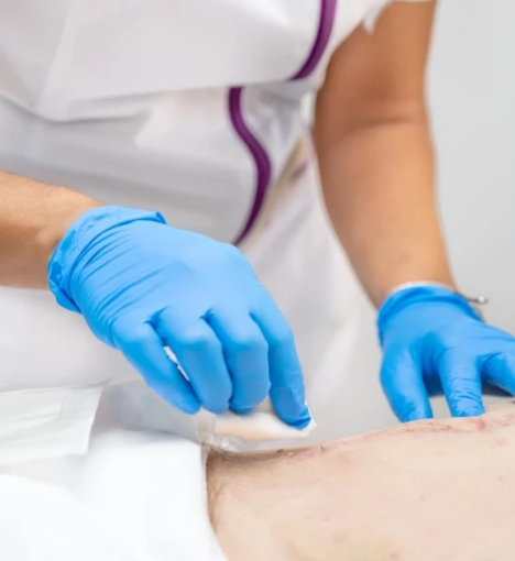 صورة خدمة تغيير جروح العمليات في المنزل