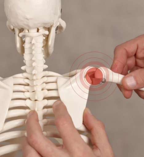 صورة نصف استبدال مفصل الورك أو الكتف – إجراء جراحي متخصص