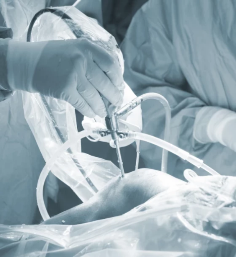 صورة تنظير مفصل الركبة