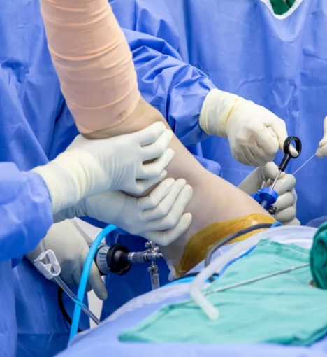 صورة تنظير الكتف وإزالة الضغط