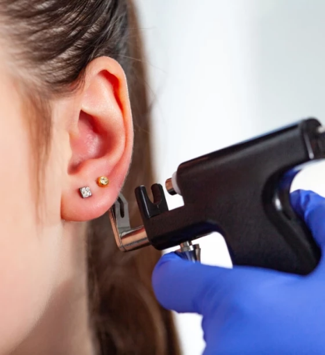 صورة بضع طبلة الأذن مع أنابيب تهوية