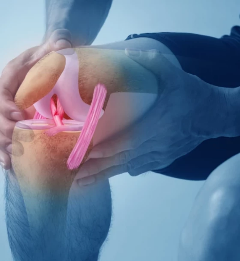 صورة عملية فصل الوريد الصافن الصغير عن الوريد المأبضي وربط الأوردة المتعددة