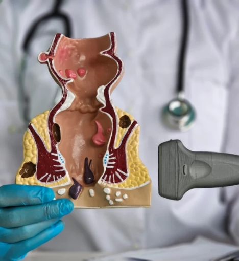 صورة عملية إزالة الخثرة من البواسير