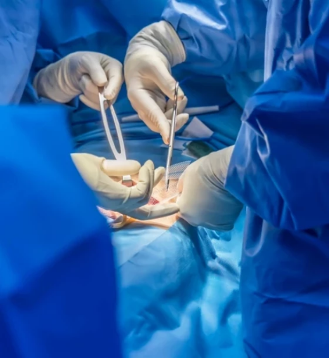 صورة عملية استئصال الورم الشحمي الكبير تحت التخدير العام