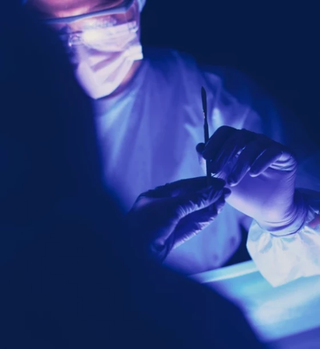 صورة عملية استئصال دوالي الخصية (جانب واحد)