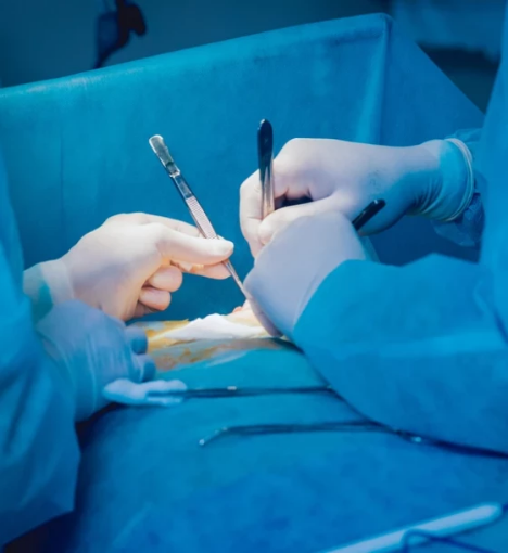 صورة عملية استئصال البواسير مع توسيع الشرج