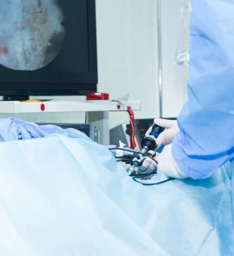 صورة عملية تفتيت حصى الحالب بالمنظار