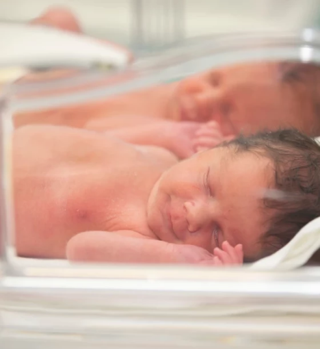 صورة عملية الولادة القيصرية للتوائم