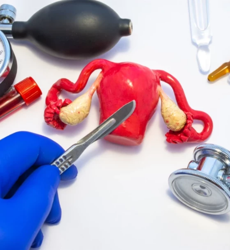 صورة عملية استئصال الرحم عن طريق البطن