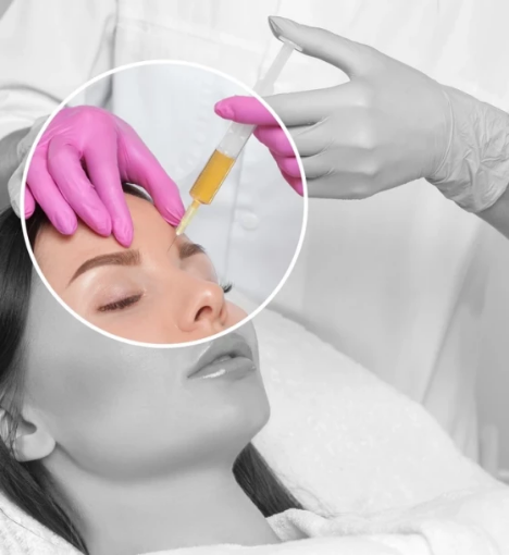 صورة جلسة ترميم ونضارة بالبلازما الذهبية