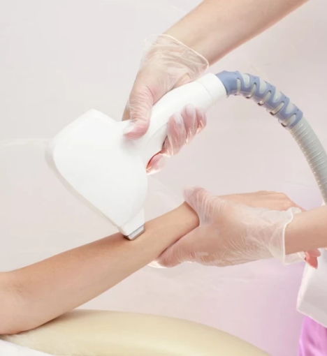 صورة 🏷️6 جلسات ليزر فل بدي مع الرتوش🏷️