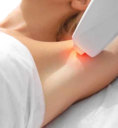 صورة 🏷️جلسة ليزر ميني بدي مع الرتوش🏷️