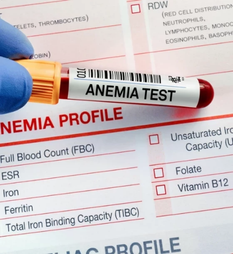 صورة باقة فقر الدم