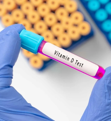 صورة تحاليل المناعة والعافية - فحص الشاملة والرعاية الصحية