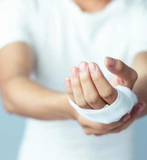 صورة العناية بالحروق من الدرجة الثالثة