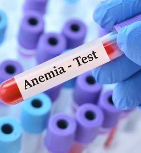 صورة باقة فقر الدم