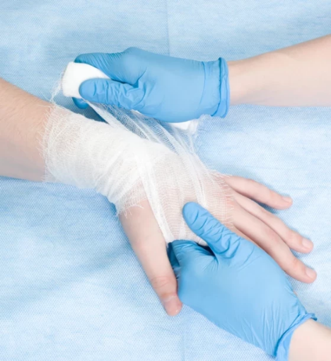 صورة خدمة العناية بحروق الدرجة الثانية في المنزل- ( الذراع، الساعد، أو الساق)