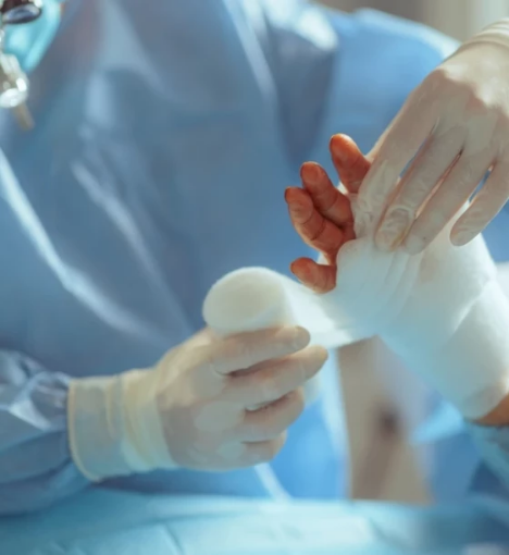 صورة خدمة إزالة القطب الجراحية في المنزل – عناية طبية آمنة ومريحة